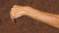 Main Line PA, Carpal Tunnel Syndrome Main Line PA, Carpal Tunnel Syndrome